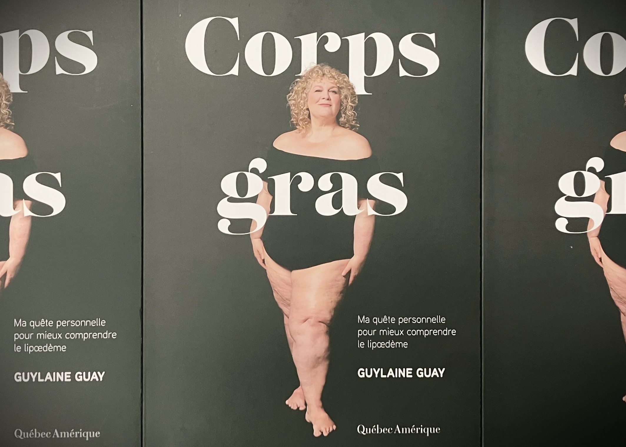 Lipœdème : Guylaine Guay lève le voile sur une maladie ignorée